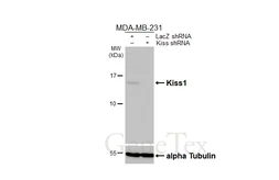 Anti-Kiss1 antibody [HL3043] used in Western Blot (WB). GTX640486