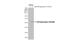 Anti-p53 (phospho Ser392) antibody [HL3047] used in Western Blot (WB). GTX640490