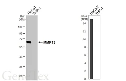 Anti-MMP13 antibody [HL3067] used in Western Blot (WB). GTX640513