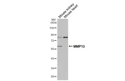 Anti-MMP13 antibody [HL3067] used in Western Blot (WB). GTX640513