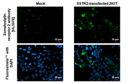 Anti-Somatostatin receptor 2 antibody [HL3078] used in Immunocytochemistry/ Immunofluorescence (ICC/IF). GTX640524