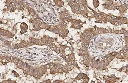 Anti-Somatostatin receptor 2 antibody [HL3078] used in IHC (Paraffin sections) (IHC-P). GTX640524