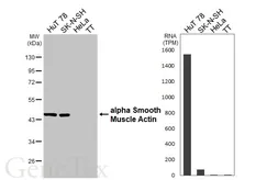 Anti-alpha Smooth Muscle Actin antibody [HL3088] used in Western Blot (WB). GTX640534