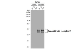 Anti-Cannabinoid receptor 2 antibody [HL3120] used in Western Blot (WB). GTX640596