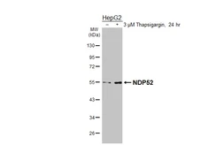 Anti-NDP52 antibody [HL3126] used in Western Blot (WB). GTX640612