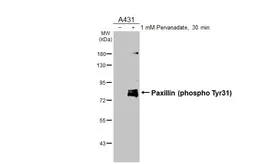 Anti-Paxillin (phospho Tyr31) antibody [HL3129] used in Western Blot (WB). GTX640615