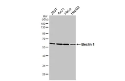 Anti-Beclin 1 antibody [HL3130] used in Western Blot (WB). GTX640616