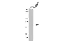Anti-SA1 antibody [HL3139] used in Western Blot (WB). GTX640631