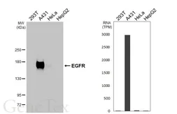 Anti-EGFR antibody [HL3153] used in Western Blot (WB). GTX640663