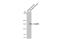 Anti-CASPR antibody [HL3160] used in Western Blot (WB). GTX640670