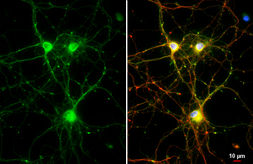 Anti-NMDAR2B antibody [HL3166] used in Immunocytochemistry/ Immunofluorescence (ICC/IF). GTX640676