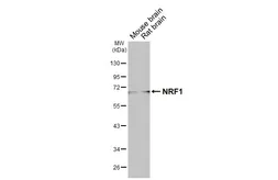 Anti-NRF1 antibody [HL3308] used in Western Blot (WB). GTX641070