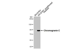 Anti-Chromogranin C antibody [HL3311] used in Western Blot (WB). GTX641073