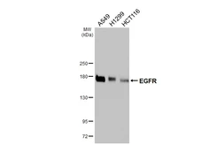 Anti-EGFR antibody [HL3325] used in Western Blot (WB). GTX641090