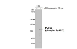 Anti-PLCG2 (phospho Tyr1217) antibody [HL3332] used in Western Blot (WB). GTX641097