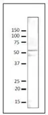 Anti-Gcn5p (S. cerevisiae) antibody used in Western Blot (WB). GTX64111