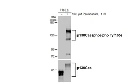 Anti-p130Cas (phospho Tyr165) antibody [HL3339] used in Western Blot (WB). GTX641111