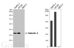 Anti-Galectin 4 antibody [HL3349] used in Western Blot (WB). GTX641126