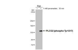 Anti-PLCG2 (phospho Tyr1217) antibody [HL3406] used in Western Blot (WB). GTX641243