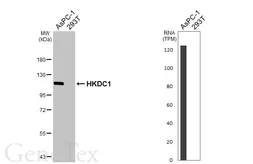 Anti-HKDC1 antibody [HL3464] used in Western Blot (WB). GTX641349