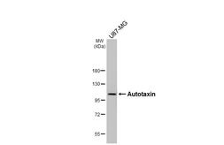 Anti-Autotaxin antibody [HL3488] used in Western Blot (WB). GTX641376