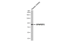 Anti-XPNPEP2 antibody [HL3492] used in Western Blot (WB). GTX641380