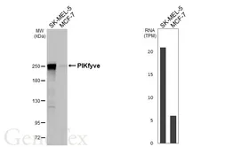 Anti-PIKfyve antibody [HL3510] used in Western Blot (WB). GTX641398