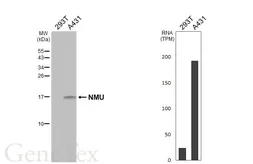 Anti-NMU antibody [HL3549] used in Western Blot (WB). GTX641455