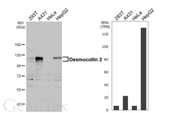 Anti-Desmocollin 2 antibody [HL3572] used in Western Blot (WB). GTX641543