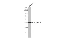 Anti-UQCRC2 antibody [HL3638] used in Western Blot (WB). GTX641629