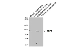 Anti-ORP8 antibody [HL3674] used in Western Blot (WB). GTX641702