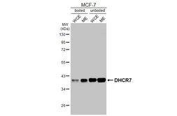 Anti-DHCR7 antibody [HL3685] used in Western Blot (WB). GTX641713