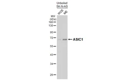 Anti-ASIC1 antibody [GT73] used in Western Blot (WB). GTX641718