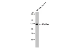 Anti-Klotho antibody [HL3707] used in Western Blot (WB). GTX641879