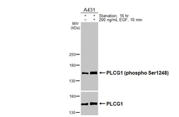 Anti-PLCG1 (phospho Ser1248) antibody [HL3719] used in Western Blot (WB). GTX641909