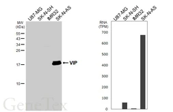 Anti-VIP antibody [HL3846] used in Western Blot (WB). GTX642080