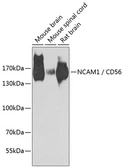 Anti-NCAM antibody used in Western Blot (WB). GTX64346
