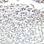 Anti-NuMA antibody used in IHC (Paraffin sections) (IHC-P). GTX64368