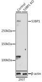 Anti-53BP1 antibody used in Western Blot (WB). GTX64370