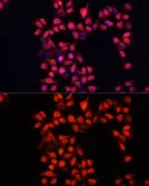 Anti-ADAM10 antibody used in Immunocytochemistry/ Immunofluorescence (ICC/IF). GTX64403