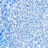Anti-ADAR1 antibody used in IHC (Paraffin sections) (IHC-P). GTX64415
