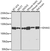 Anti-Dynamin 2 antibody used in Western Blot (WB). GTX64478