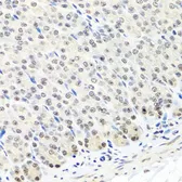 Anti-CNOT8 antibody used in IHC (Paraffin sections) (IHC-P). GTX64486