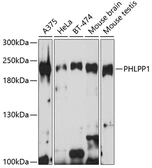 Anti-PHLPP1 antibody used in Western Blot (WB). GTX64568