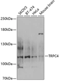 Anti-TRPC4 antibody used in Western Blot (WB). GTX64614