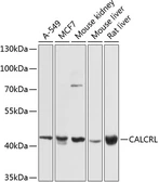 Anti-CRLR antibody used in Western Blot (WB). GTX64616
