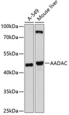 Anti-AADAC antibody used in Western Blot (WB). GTX64718