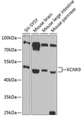 Anti-KCNK9 antibody used in Western Blot (WB). GTX64833