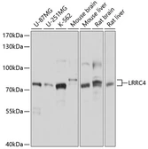 Anti-LRRC4 antibody used in Western Blot (WB). GTX64855