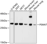 Anti-PSMA7 antibody used in Western Blot (WB). GTX64902